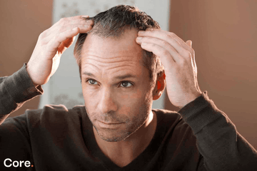 Minoxidil eredmények: mikor látszik a hatás? – Útmutató a valós eredményekhez
