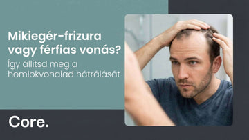 Mikiegér-frizura vagy férfias vonás? – Így állítsd meg a homlokvonalad hátrálását