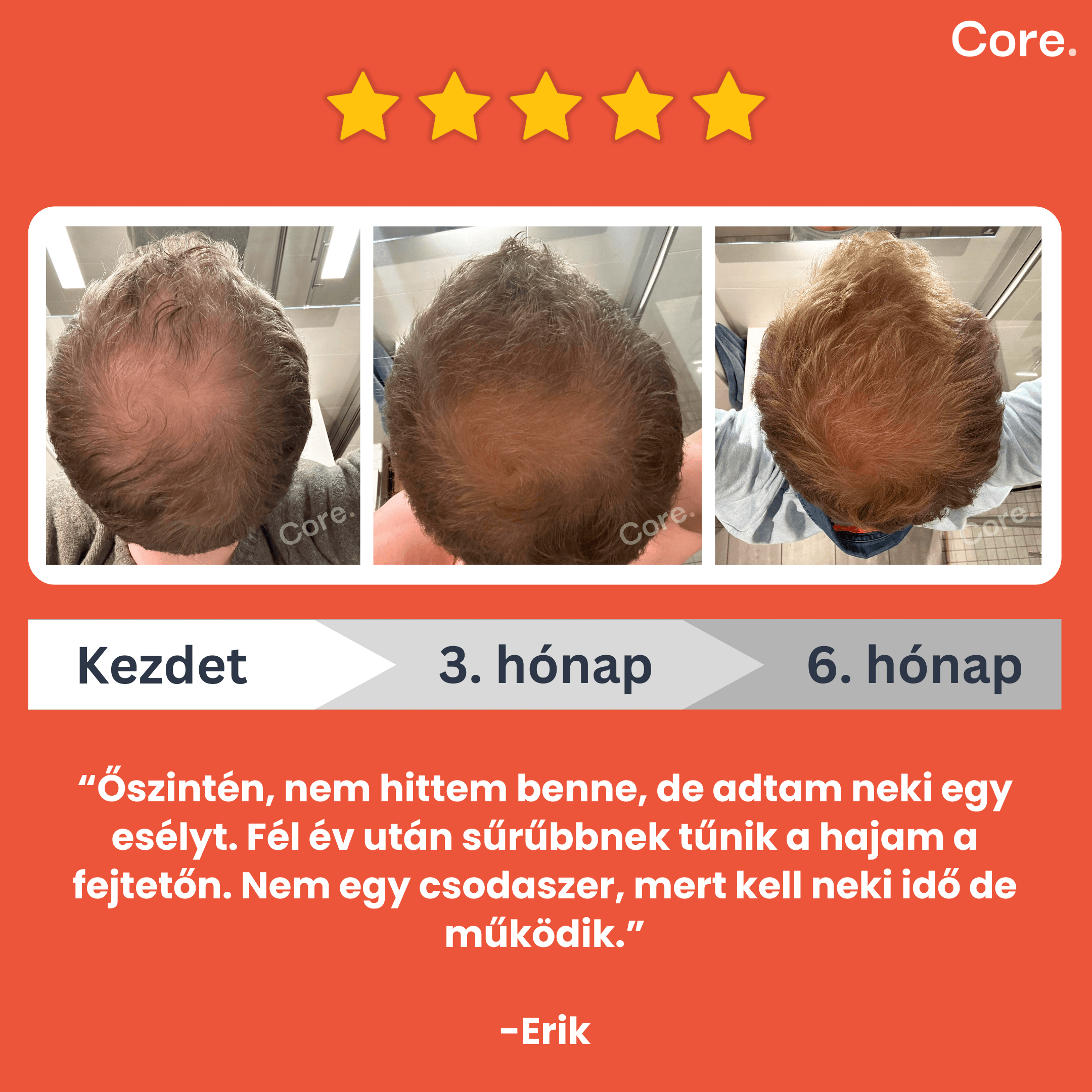 Kirkland Minoxidil 5% haj-, és szakállnövesztő - 2 havi adag folyadék