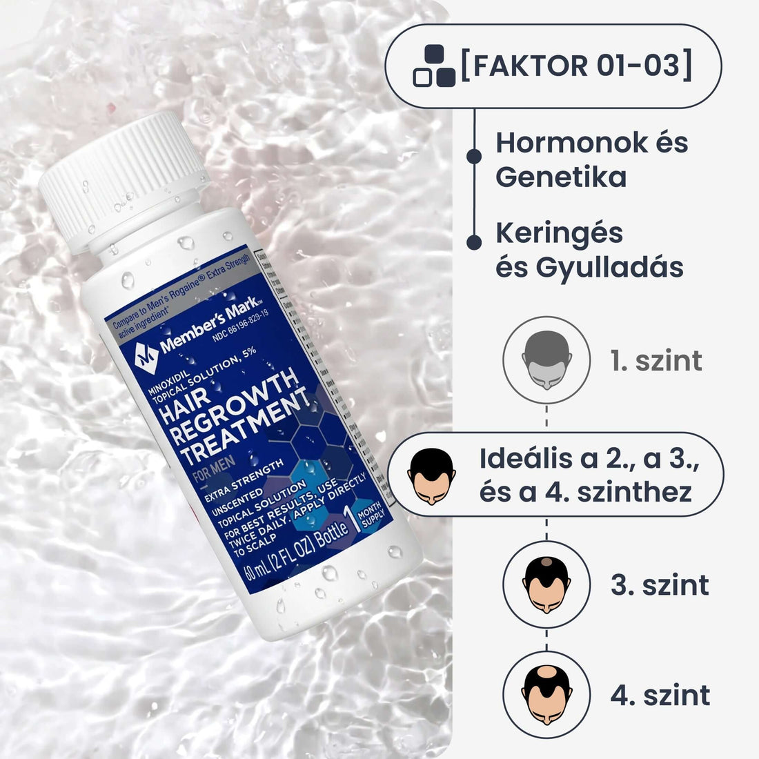 Member's Mark Minoxidil 5% haj-, és szakállnövesztő - 3 havi adag folyadék